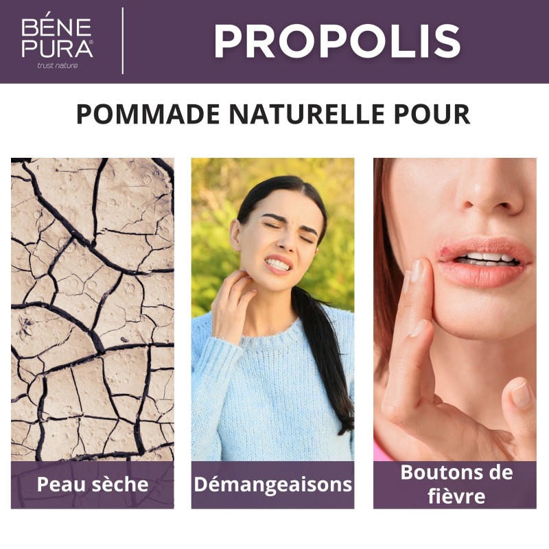 Pommade Propolis pour Peau très Sèche avec 30% Propolis - 40ml