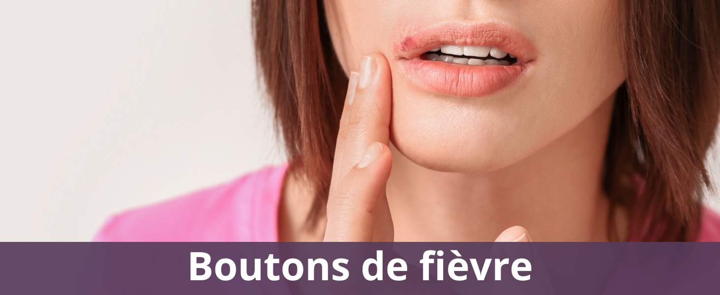 Boutons de fièvre