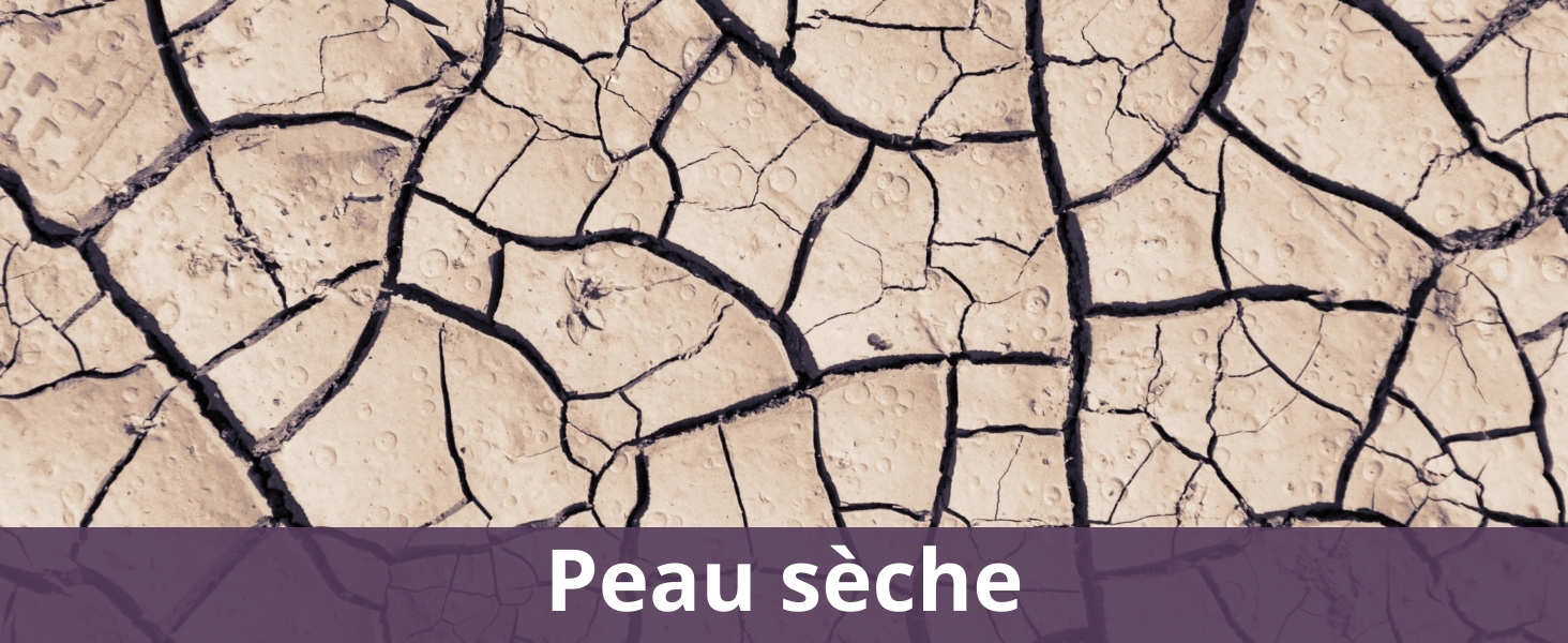 Peau sèche