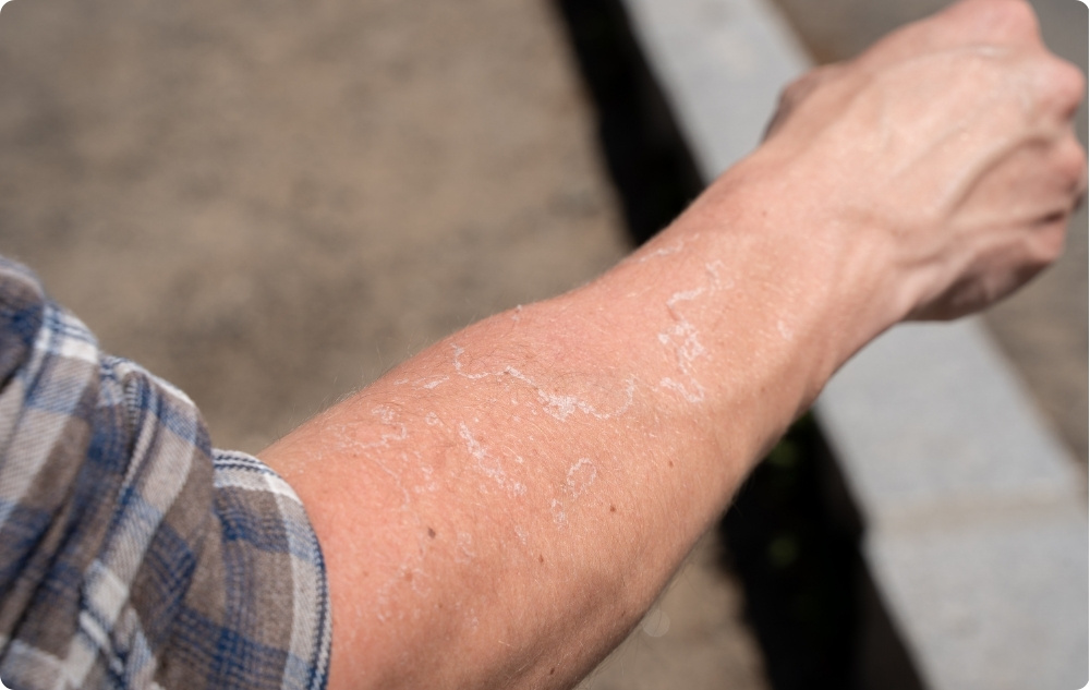 Comme huile pour les peaux irritées et sèches