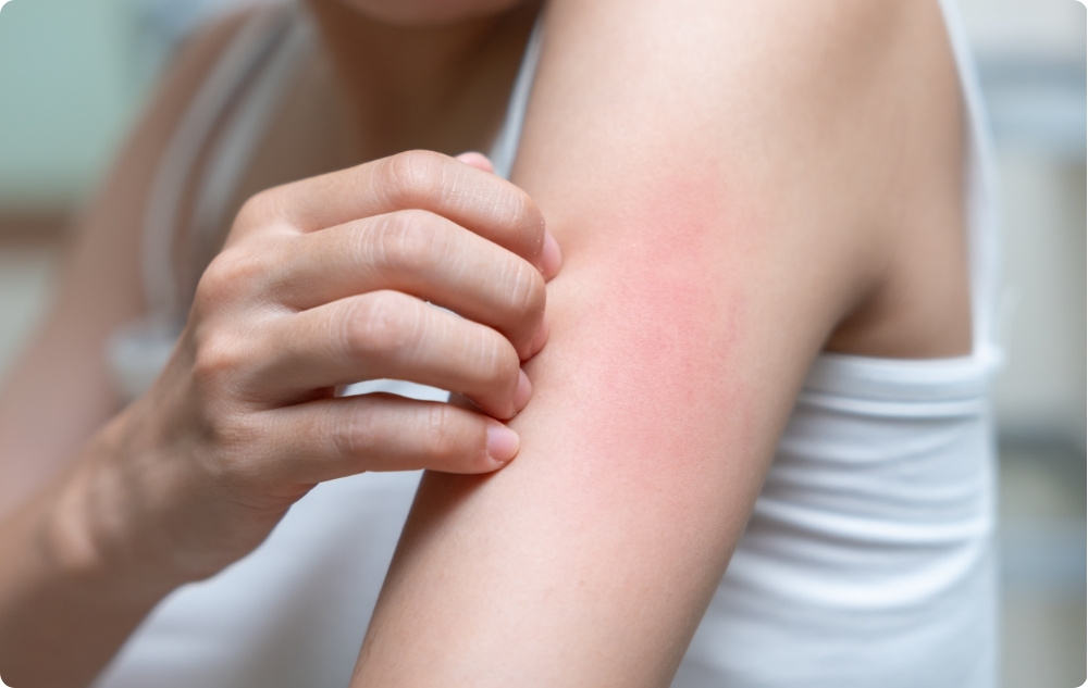 Comme huile apaisante pour les peaux sensibles ou irritées