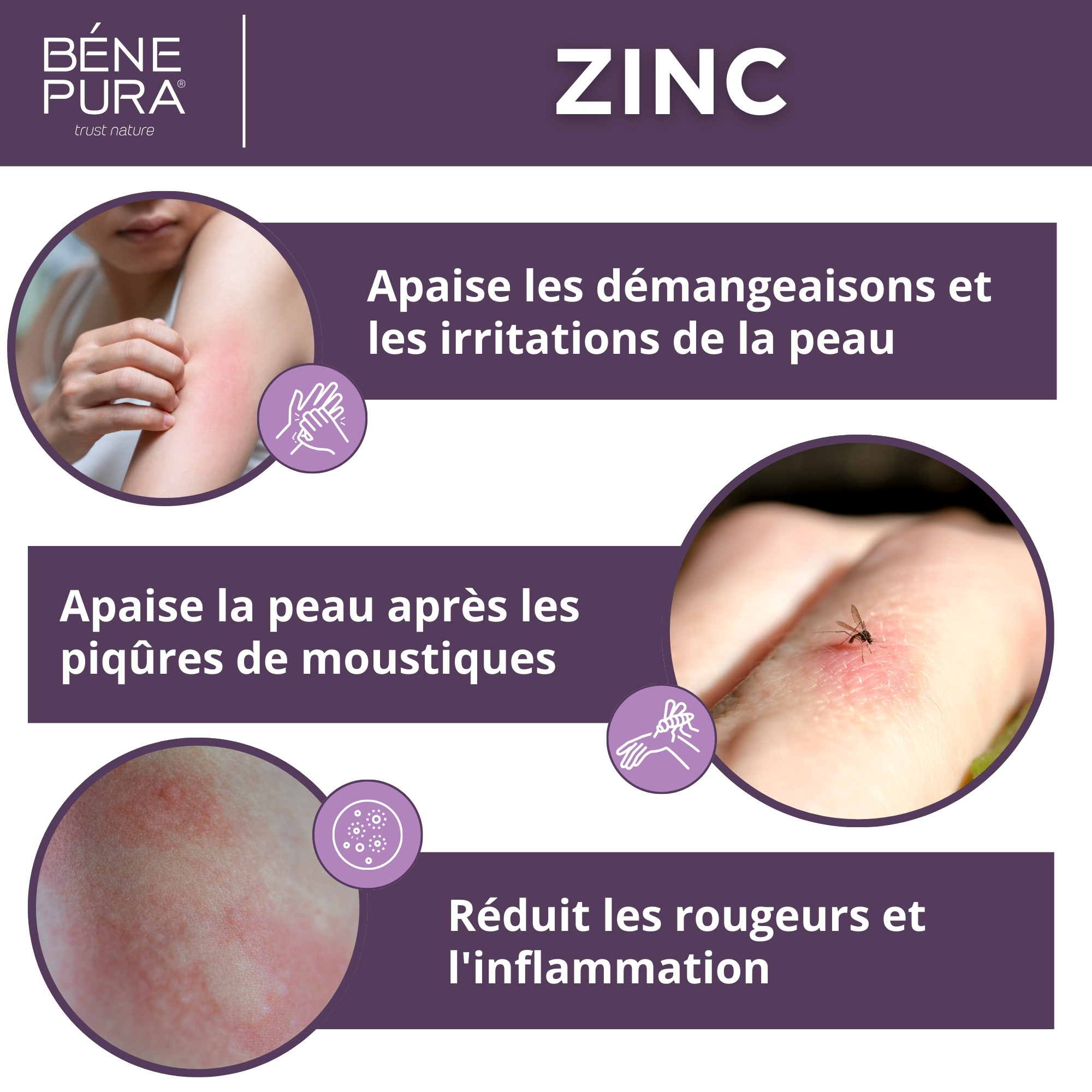 Pommade Oxyde de Zinc pour les Éruptions cutanées et Démangeaisons - 40ml